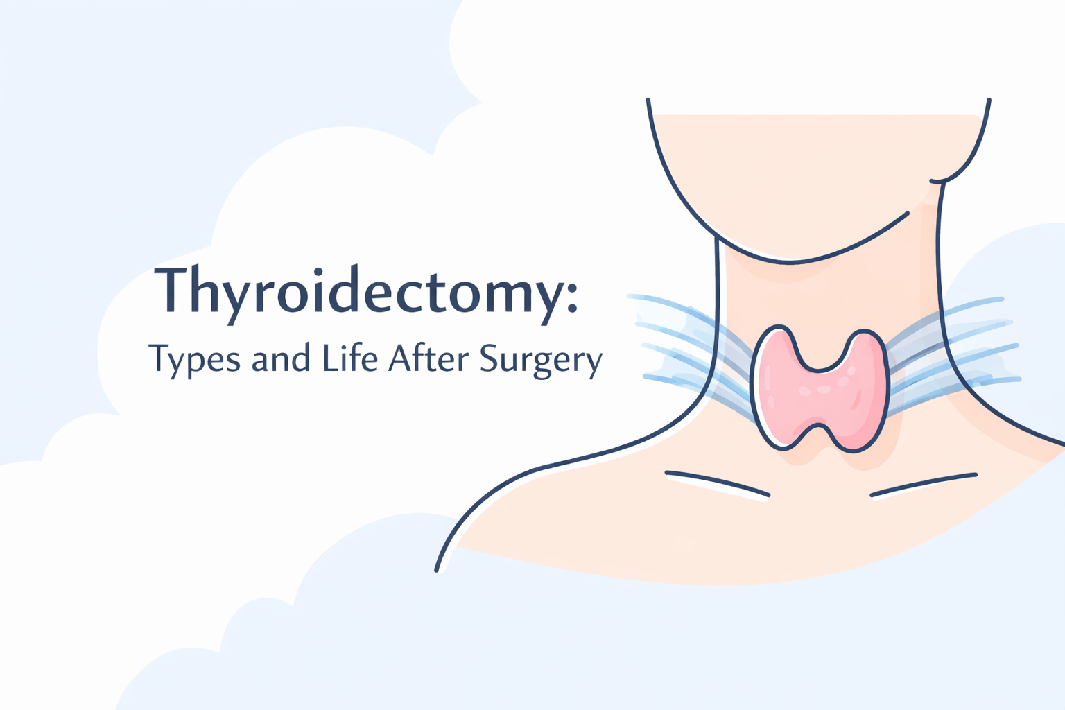 تیروئیدکتومی